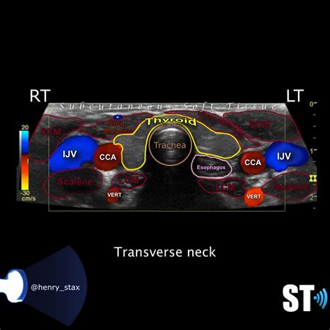 Thyroid Ultrasound Examination Basics