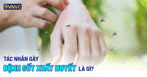 Tác nhân gây ra bệnh sốt xuất huyết là gì? Những điều bạn cần chú ý