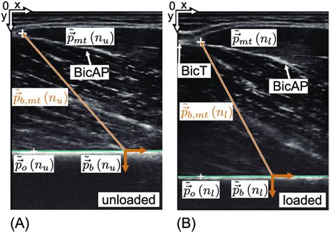 Ultrasonic images of the myotendinous junction (white cross) in the... | Download Scientific Diagram