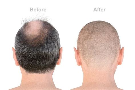 Shaving My Head Was An Experience Investors Can Learn From. Here’s How.