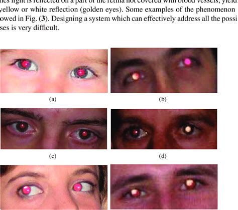 Examples of the variability of the red eye phenomenon. Golden eyes are ...