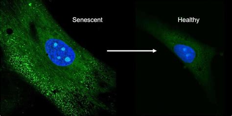 New drug delivery method can reverse senescence of stem cells