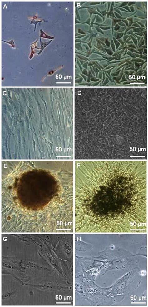 The different stages of retinal pigment epithelium (RPE) cell growth in... | Download Scientific ...