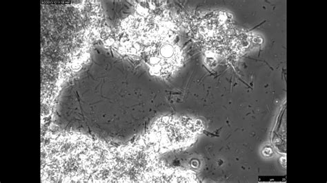 Human dental plaque sample viewed using an inverted microscope, in bright field phase contrast ...