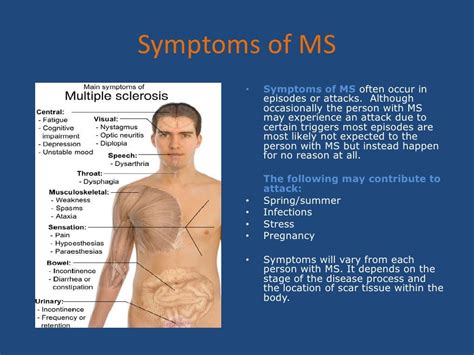 Multiple Sclerosis Powerpoint