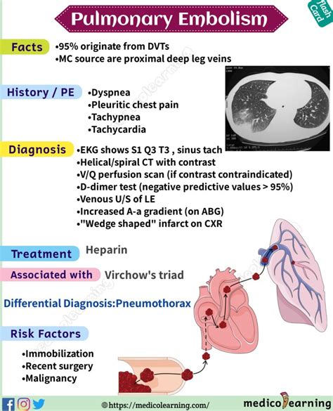 Pulmonary Embolism Causes