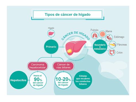 Cáncer de Hígado: ¿Qué es? | Roche Pacientes