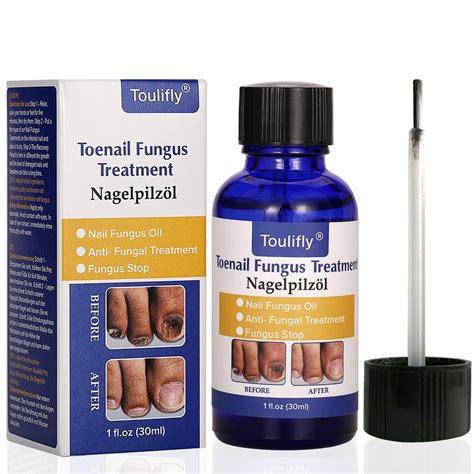 Buy Fungus Stop, Nail Fungus , Toenail Fungus Nail Polish, Toenail ...