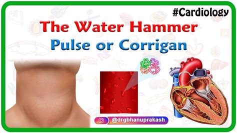 How Do You Know If Your Pulse Is Collapsing? All Answers ...