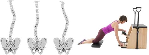 Rehabilitation Pilates exercises for Scoliosis