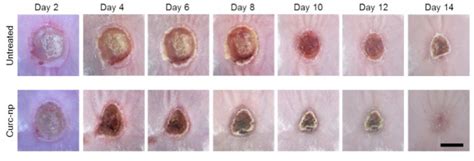 Nanotechnology accelerates wound healing