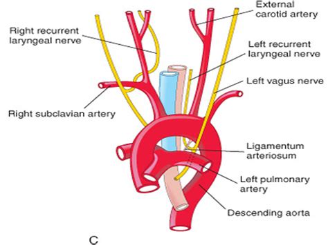 Recurrent laryngeal nerve - Google 검색 | Carotid artery, Subclavian ...