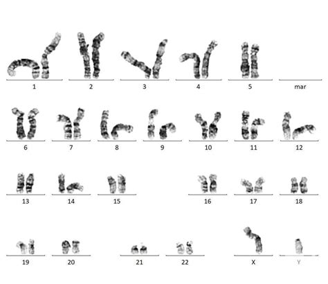 Image showing metaphase, processed metaphase and Karyotype 3