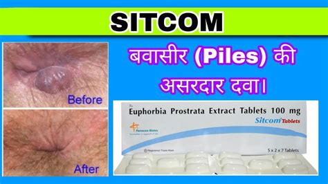 Sitcom Tablet | Euphorbia Prostrata Extract Tablets 100 mg | Piles Treatment - YouTube