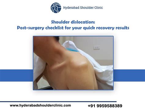 Shoulder dislocation: Post-surgery checklist for your quick recovery ...