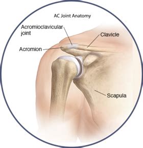 Separated Shoulder | AC Joint Separation | Local Shoulder Surgeon