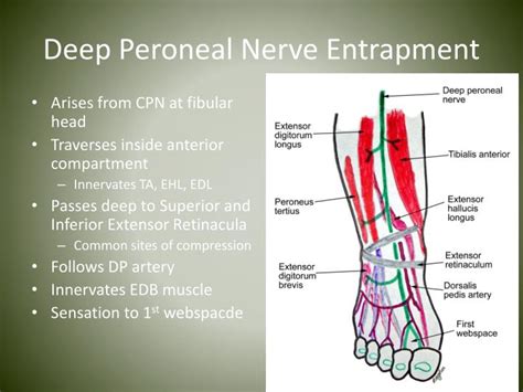 PPT - Nerve Entrapments in Runners PowerPoint Presentation - ID:4539042