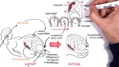 Obstetrics - Stages of Labour