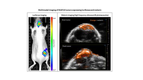 Photoacoustic imaging - Imanis Life Sciences | United States