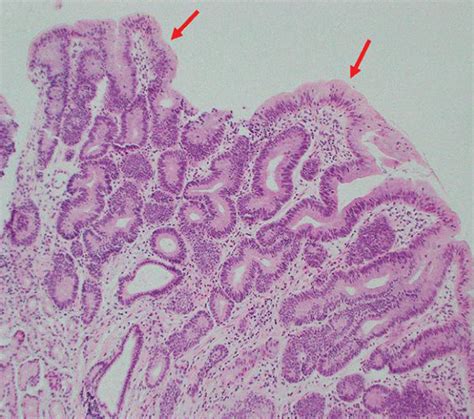 Representative images of structural atypia area (red-lined inner area)... | Download Scientific ...