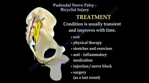 Pudendal nerve entrapment syndromes, Physiotherapy Treatment,Exercise ...