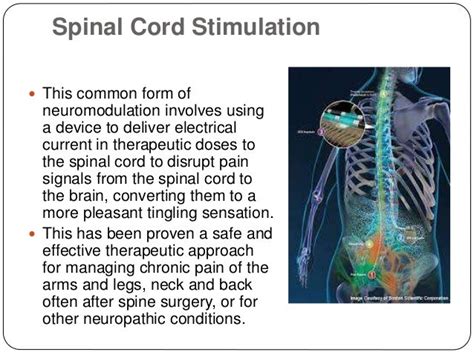 Neuromodulation