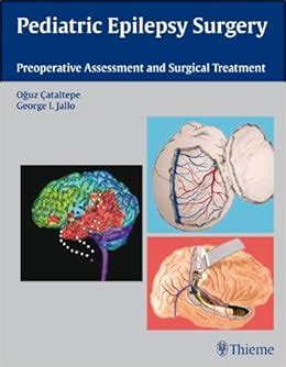 Pediatric Epilepsy Surgery: Preoperative Assessment and Surgical Treatment: 9781604062540 ...