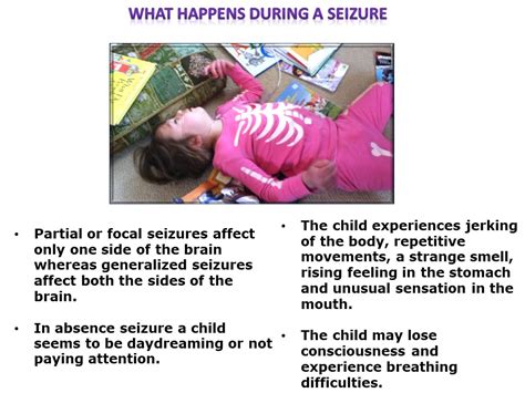 Absence Seizures In Adults