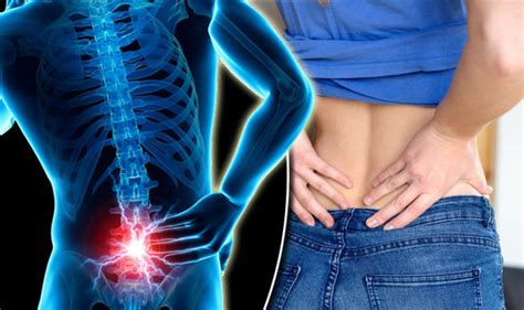 Back pain symptoms - signs a lower back condition could be serious | Express.co.uk