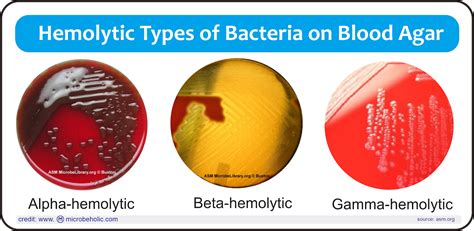 Blood Agar - Definisi, Komposisi, Cara Pembuatan dan Interpretasi Hasil - MicrobeHolic