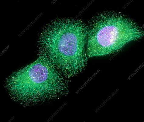 HaCaT culture cells - Stock Image - G442/0177 - Science Photo Library