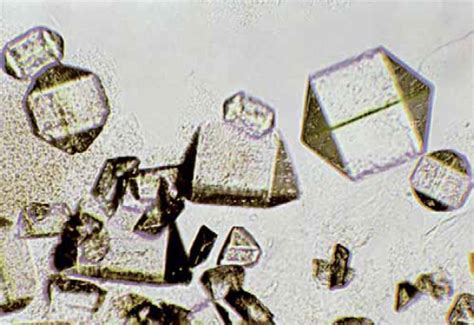 variation in Triple phosphate crystals | Medical Laboratories