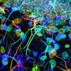 Types of glia - Queensland Brain Institute - University of Queensland