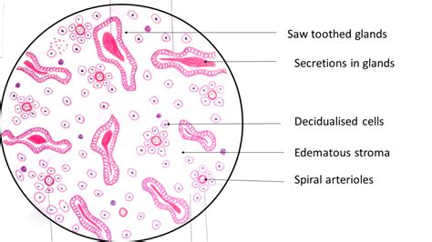 Endometrium: Secretory phase - Pathology Made Simple