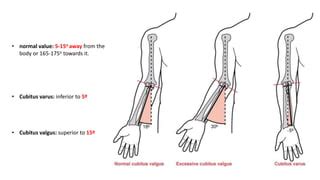 Cubitus valgus varus | PPT