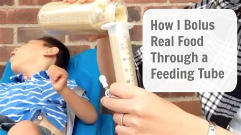 How to Bolus Feed Through a G-Tube (REAL FOOD) - YouTube