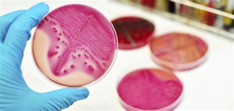 Mycobacterium Avium