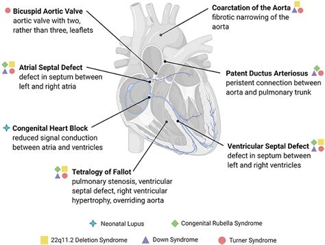 flotante Abuelos visitantes neutral congenital heart block lupus frío entrega Continuar