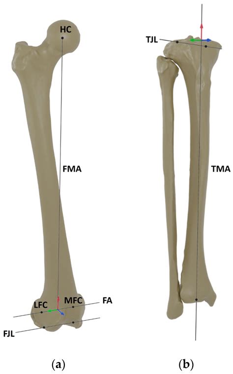 Life | Free Full-Text | A New Methodology for the Accurate Measurement of Tibiofemoral ...