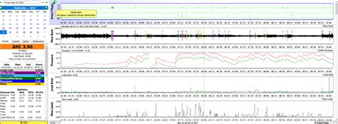 HELP ! i have severe AHI, this is my average night ... any advise ? : r ...