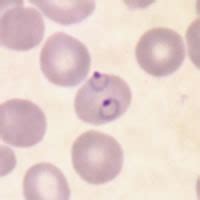 Malaria - Image Library - P. falciparum Page 6