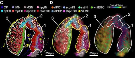 The first spatiotemporal map of brain regeneration in the axolotl