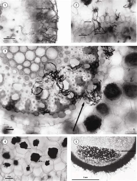 1. Mycorrhizal colonisation of the velamen in E. secundum root (arrow).... | Download Scientific ...