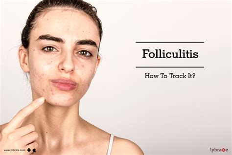 Folliculitis - How To Track It? - By Dr. Umesh Bilewar | Lybrate