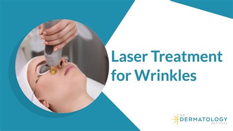 Laser Treatment for Wrinkles Removal - Oasis Medical Aesthetics