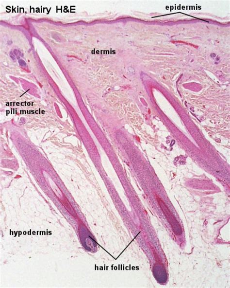 Hair Under Microscope Labeled