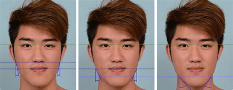 Representative images demonstrating measurement areas for facial ...