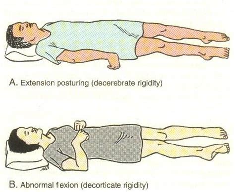 Pin on Neurology Module