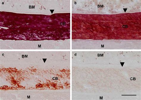 Alizarin red S staining of cortical bone. Sections decalcified for 0 ...