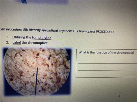 Answered: What is the function of the… | bartleby